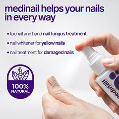 Jaysuing Nail Fungus Spray 100ml Antifungal Nail Care Solution