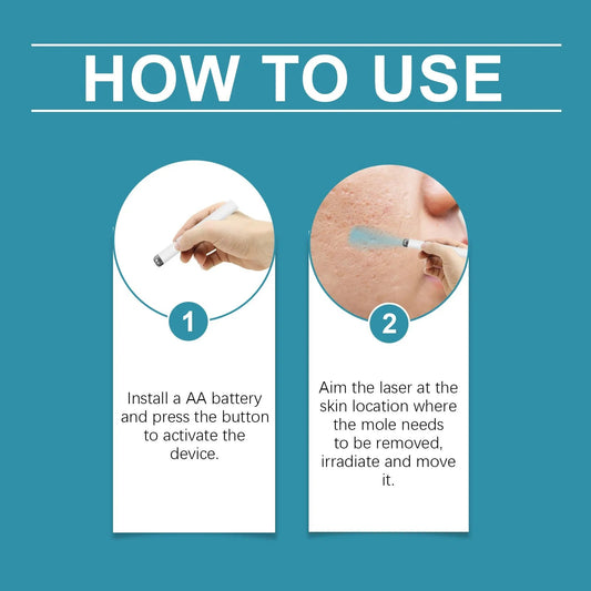 Xorita Non-Invasive Skin Care Laser Pen Precision Beauty Device Tool