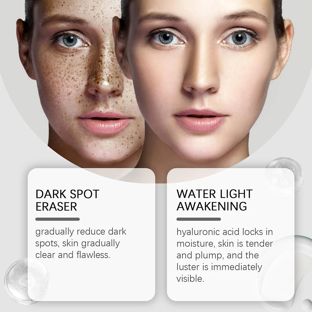 Hoygi Dark Spot Repair Lotion Brightening Even Tone Corrector 30ml