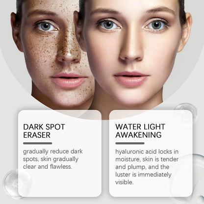 Hoygi Dark Spot Repair Lotion Brightening Even Tone Corrector 30ml