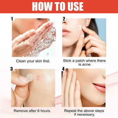 Hydrocolloid Acne Cleaning Patch for Spot Treatment Blemish Care 144 Patches