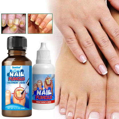 Sumifun Nail Fungus Treatment Liquid Antifungal Nail Repair Solution 20ml