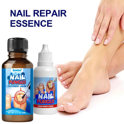 Sumifun Nail Fungus Treatment Liquid Antifungal Nail Repair Solution 20ml