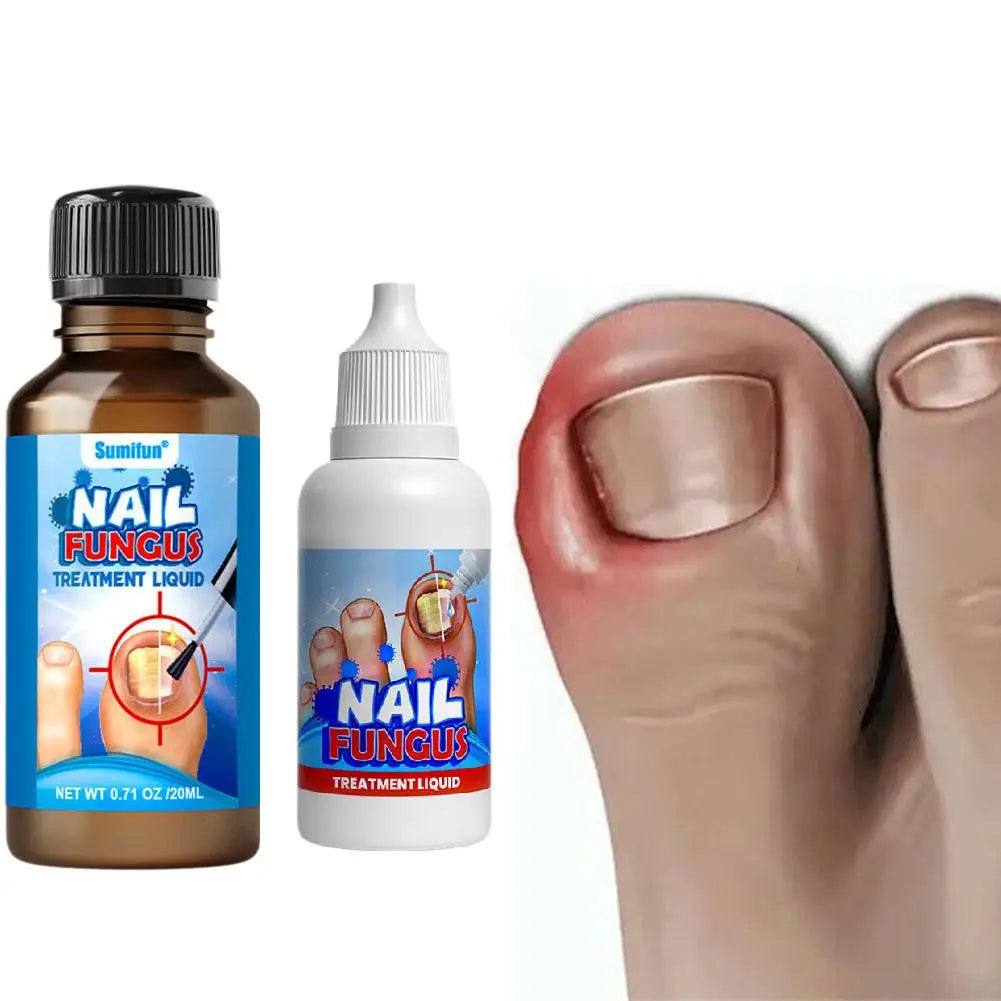 Sumifun Nail Fungus Treatment Liquid Antifungal Nail Repair Solution 20ml