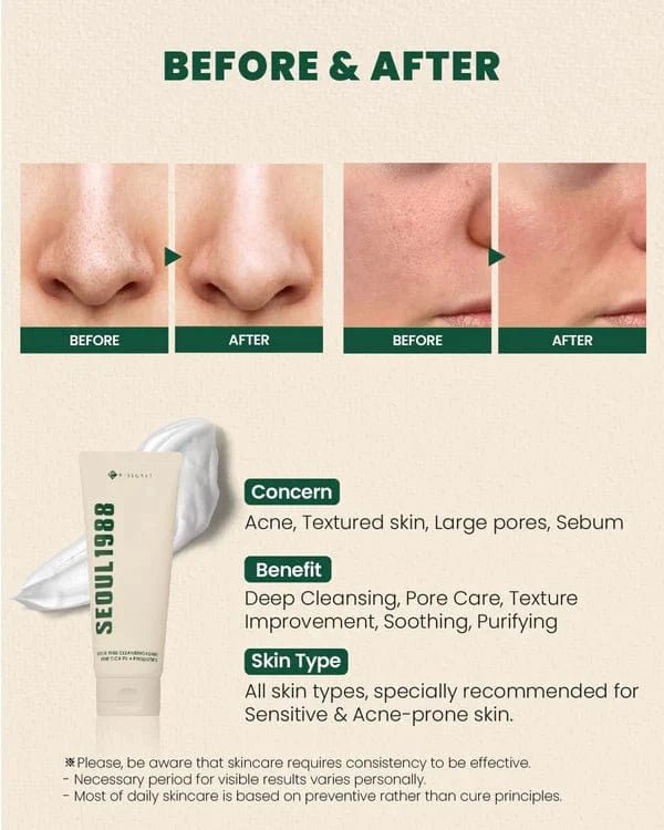 Seoul 1988 Pine Cica Cleansing Foam Probiotics Gentle Facial Cleanser