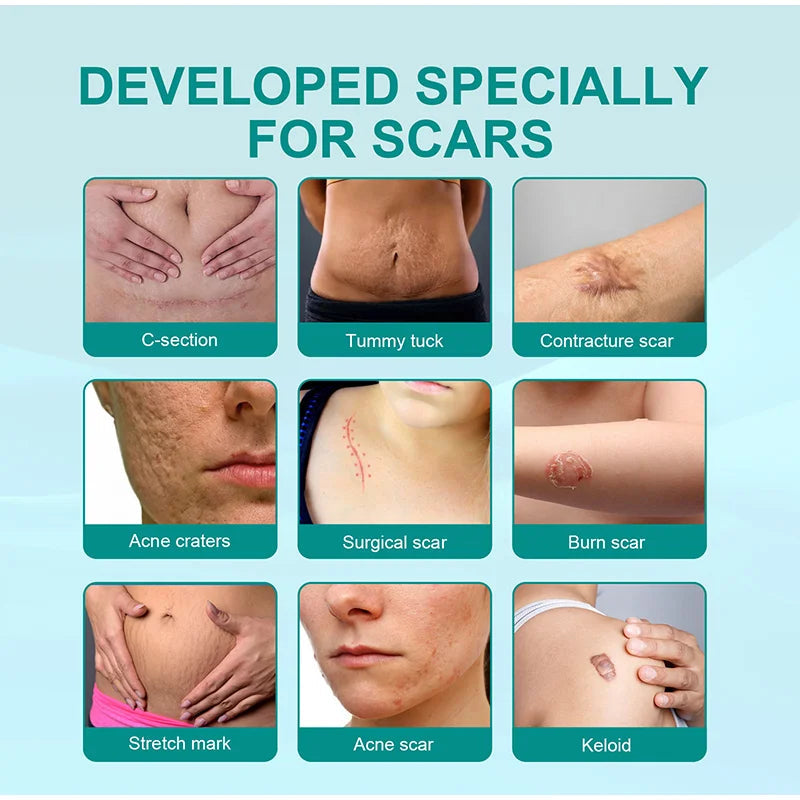 South Moon Scar Repair Spray +Skin Regeneration Texture Smoothing Mist