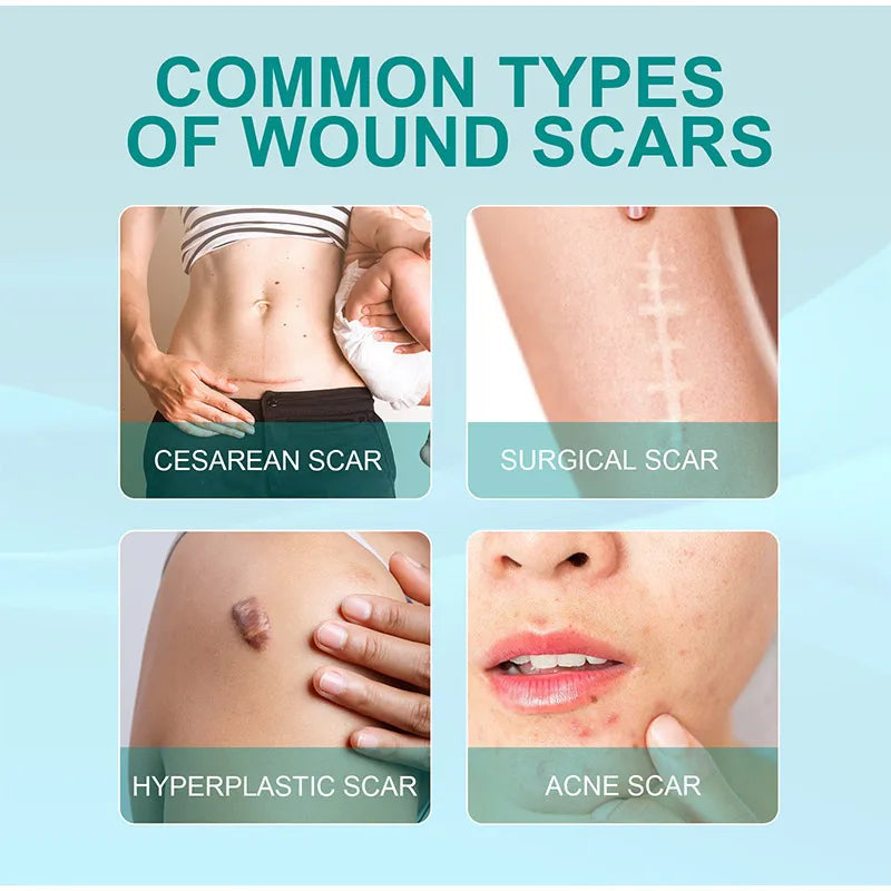 South Moon Scar Repair Spray +Skin Regeneration Texture Smoothing Mist