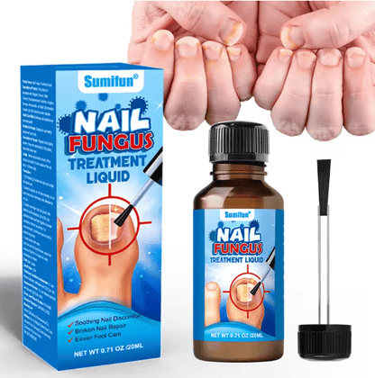 Sumifun Nail Fungus Treatment Liquid Antifungal Nail Repair Solution 20ml