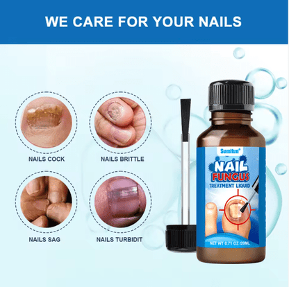 Sumifun Nail Fungus Treatment Liquid Antifungal Nail Repair Solution 20ml