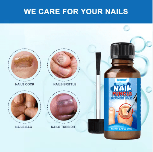Sumifun Nail Fungus Treatment Liquid Antifungal Nail Repair Solution 20ml